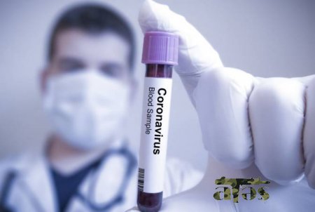 Azərbaycanda daha 104 nəfərdə koronavirus aşkarlandı, 1 nəfər öldü – RƏSMİ