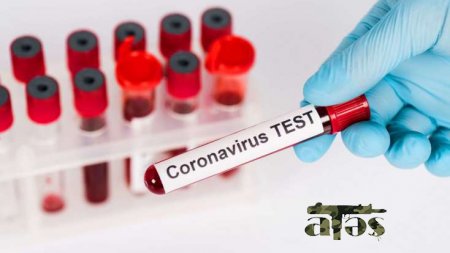 Koronavirus peyvəndinin qiyməti bəlli oldu