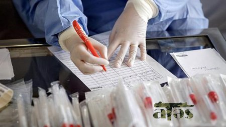 Bakıda koronavirus testi neqativ çıxdı, pozitiv təqdim etdilər