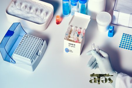 Deputatların koronavirus testinin nəticələri açıqlandı